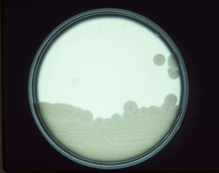 Слика од Clostridium perfringens