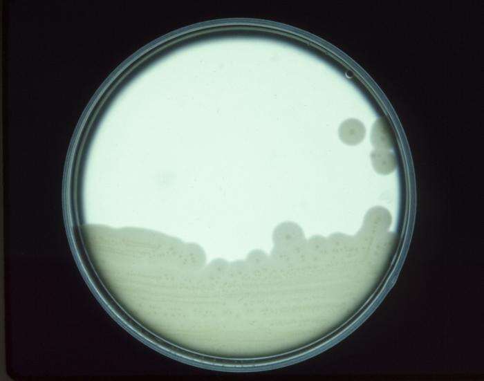 Image de Clostridium perfringens