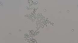 Image of unclassified Saccharomycetales