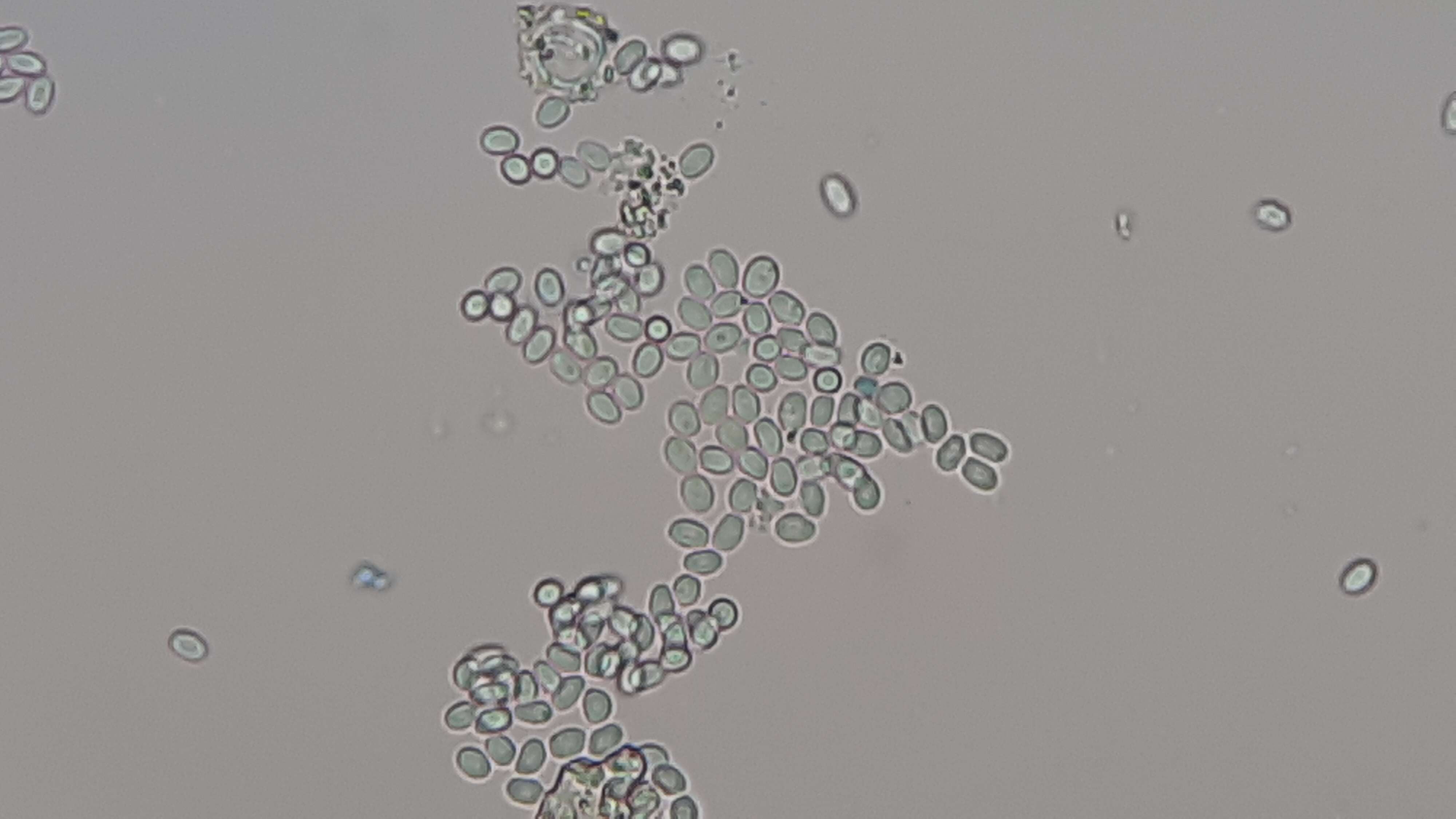 Imagem de unclassified Saccharomycetales