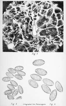 Image of <i>Capillaria hepatica</i>