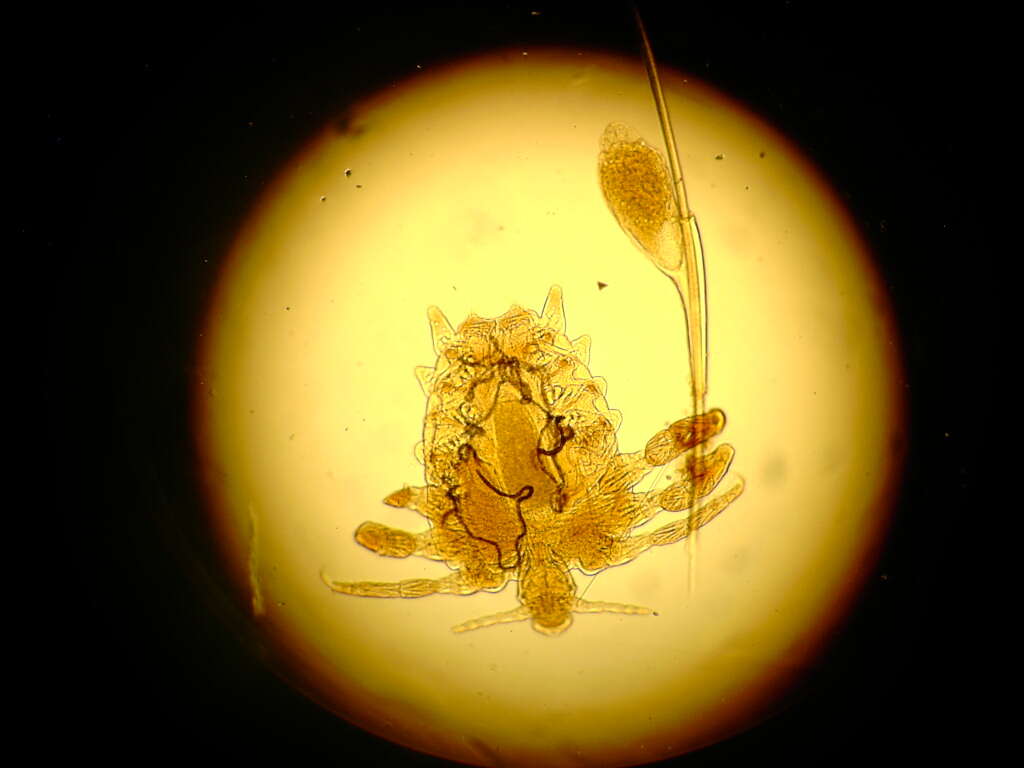 Image of lice