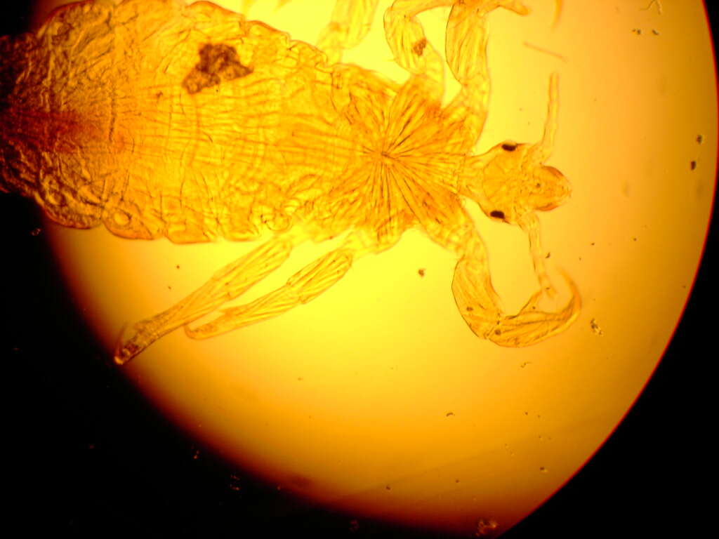 Image of lice