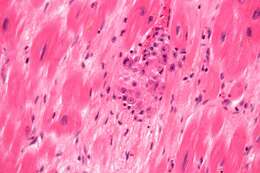 Image de Streptococcus pyogenes
