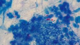 Image of Mycobacterium