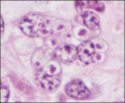 Image of Areospora rohanae G. D. Stentiford, S. Bateman, S. W. Feist, S. Oyarzún, J. C. Uribe, M. Palacios & D. M. Stone 2014