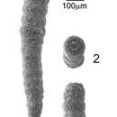 Image of Polysaccammina hyperhalina Medioli, Scott & Petrucci 1983
