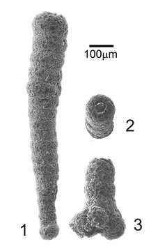 Image of Polysaccammina hyperhalina Medioli, Scott & Petrucci 1983