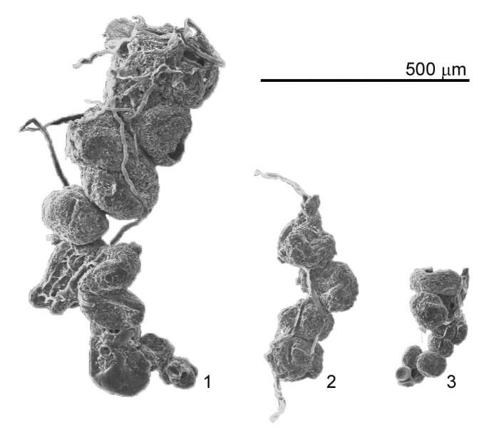 صورة Polysaccamminidae