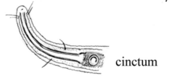 Image of Rhynchonema cinctum Cobb 1920