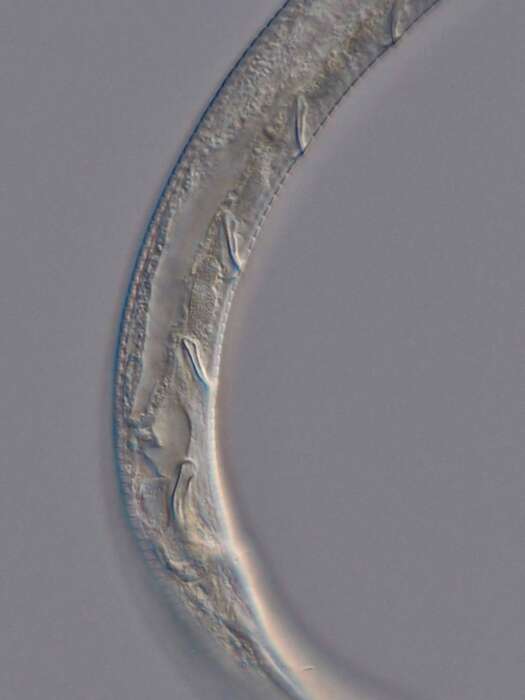 Image of Antomicron quindecimpapillatus Holovachov 2012
