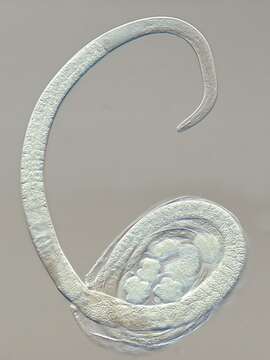 Image of Onchium metocellatum (Wieser 1956) Gerlach & Riemann 1973