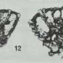 Image of Pseudorotalia schroeteriana (Parker & Jones ex Carpenter 1862)