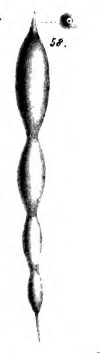 Image of Nodosaria intertenuata Schwager 1866