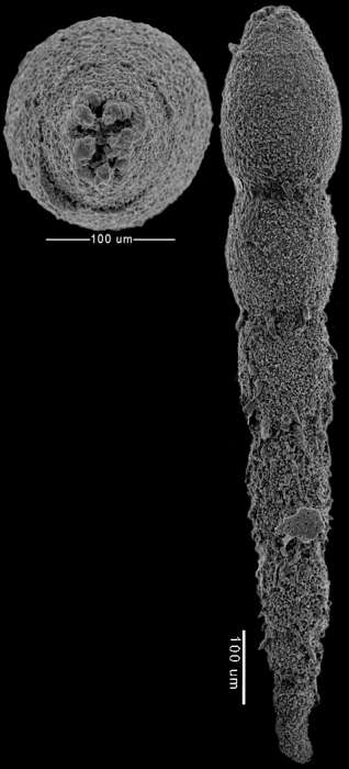 Image of Anastomosa loeblichi Hayward & Van Kerckhoven 2012