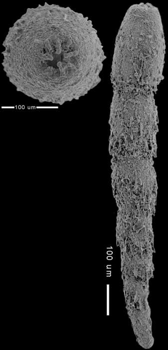 Image of Anastomosa loeblichi Hayward & Van Kerckhoven 2012