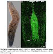 Image of Pseudaphanostoma divae Marcus 1952