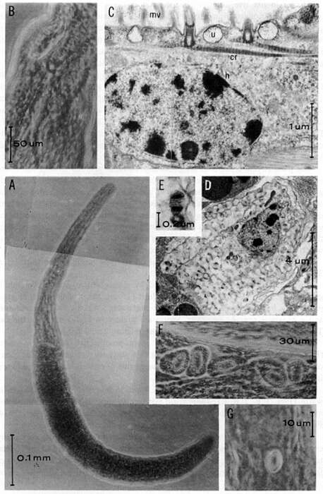 Plancia ëd Retronectes atypica Doe & Rieger 1977