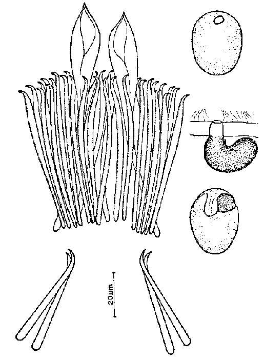 Image of Coelogynopora cochleare Ax & Sopott-Ehlers 1979