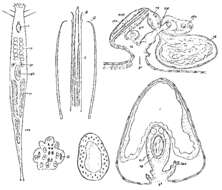 Image of Postbursoplana minima Ax 1956