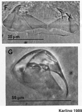 Image of Uncinorhynchus