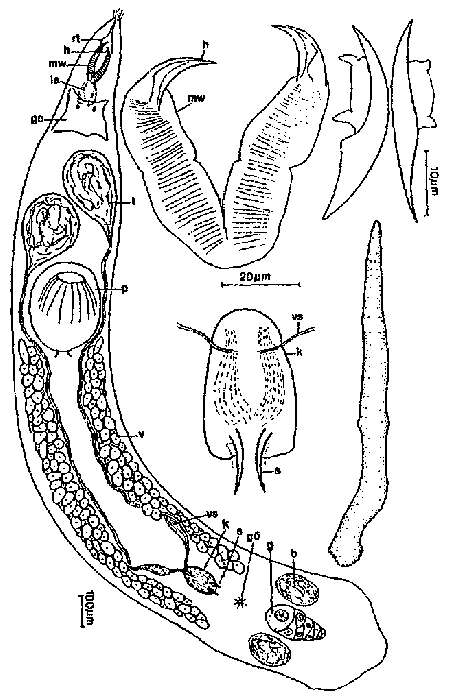 Image of Karkinorhynchus primitivus Meixner 1928