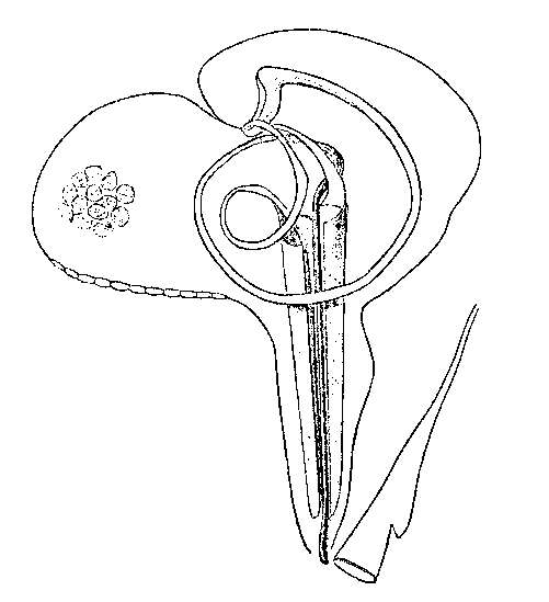 Sivun Trigonostomum armatum (Jensen 1878) kuva