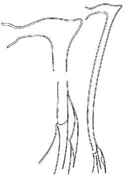 Imagem de Promesostoma digitosum Ax 1995