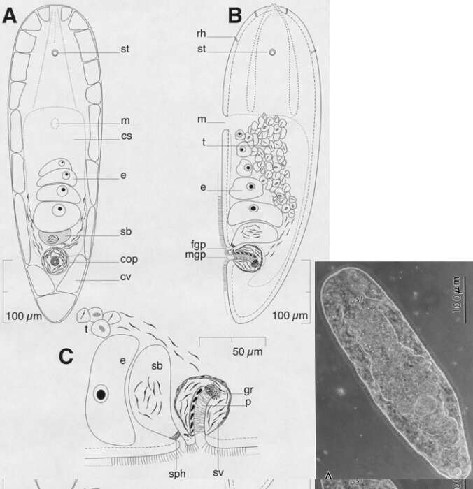 Image of Praeaphanostoma wadsworthi Hooge & Tyler 2003