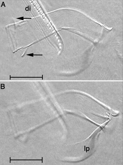 Image of Cephalopharynx