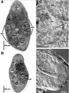 Image of Childia vivipara Tekle, Raikova & Jondelius 2006