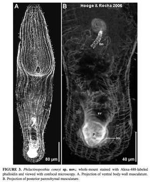 Image of Philactinoposthia coneyi Hooge & Rocha 2006