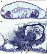 Image of Praeaphanostoma foramivora Hooge & Tyler 2008