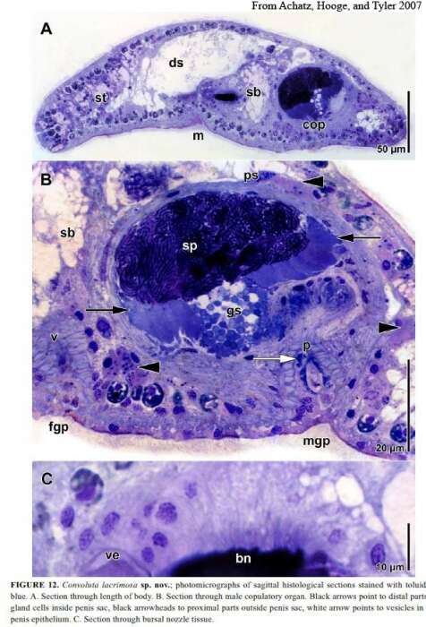 Image of Convoluta lacrimosa Achatz, Hooge & Tyler 2007