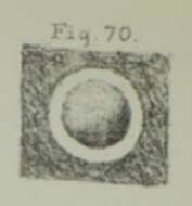 Image of Calcisphaera laevis Williamson 1880