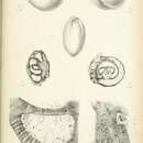 Image of Archaediscus karreri Brady 1873