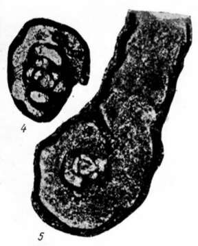 Image of Lituotubella glomospiroides Rauzer-Chernousova 1948