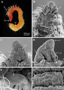 Image of Aricidea (Aricidea) thammapinanae Plathong, Hernández-Alcántara, Harris & Plathong 2020