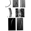 Image of Halalaimus aciculus Gagarin & Thanh 2014