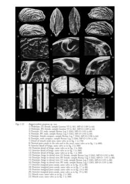 Image of Ruggiericythere purperae Aiello, Coimbra & Barra 2004