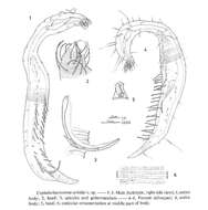 Image de Bathychaetosoma uchidai (Kito 1983) Decraemer, Gourbault & Backeljau 1997