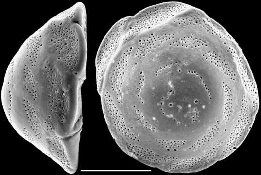 Слика од Pileolina patelliformis (Brady 1884)