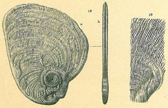 Image de Cornuspiroides striolata (Brady 1882)