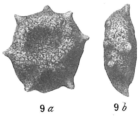 Image of Thurammina compressa Brady 1879