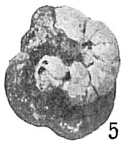 Image of Placopsilina cenomana d'Orbigny 1850