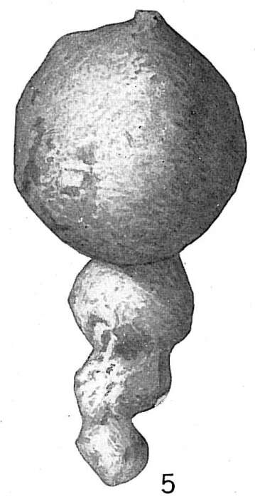 Image of Hormosina globulifera Brady 1879