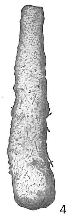 Image de Hyperammina friabilis Brady 1884