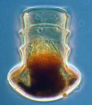 Слика од Amplectella collaria (Brandt) Kofoid & Campbell 1929