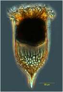 Image of Epiplocylis blanda (Jörgensen 1924) Kofoid & Campbell 1939