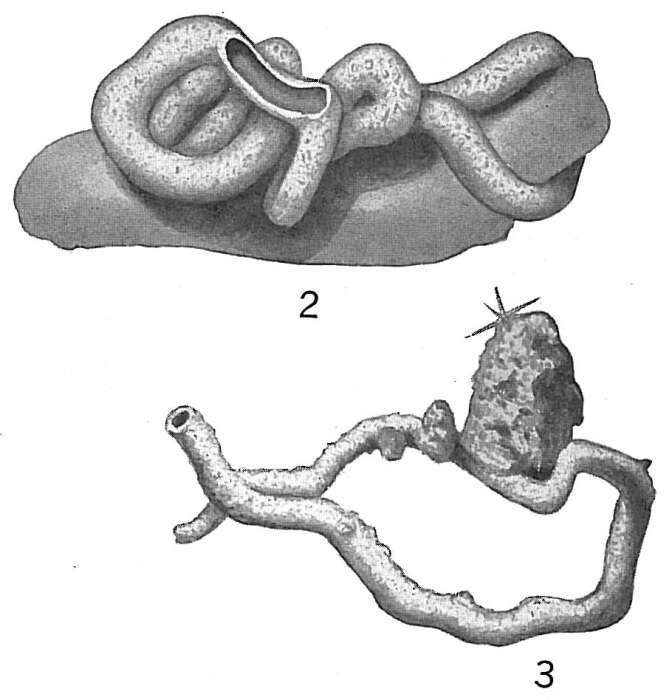 Image of Tolypammina vagans (Brady 1879)